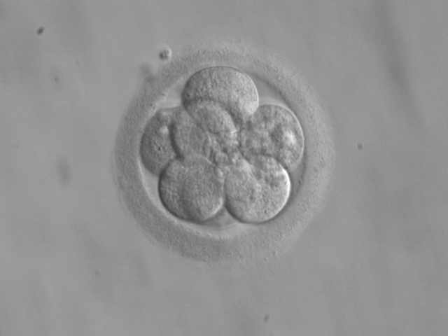 Bestand:Embryo, 8 cells.jpg