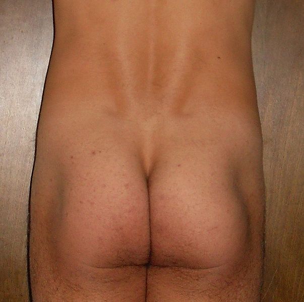 Bestand:603px-1-male-buttocks-and-lower-back.jpg