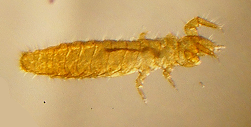 Bestand:Protura (Acerentomon species) micrograph.jpg