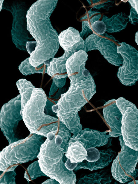 Bestand:450px-Campylobacter.jpg