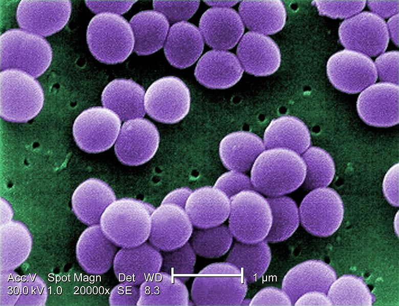 Bestand:780px-Staphylococcus aureus VISA 2.jpg