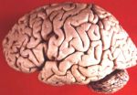 Miniatuur voor Bestand:Human brain lateral view.jpg