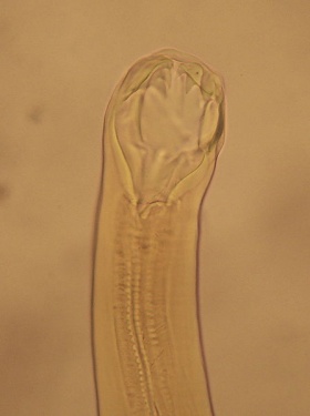 De (sterk vergrootte) kop van een mijnworm (Ancylostoma duodenale).