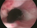 Miniatuur voor Bestand:Cervix uteri 1.jpg