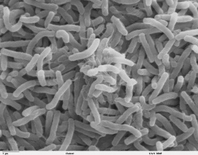 Bacteriën (Cholera)