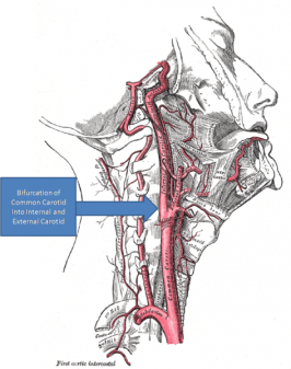 De rechter halsslagader (arteria carotis communis).